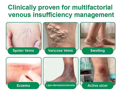 🦵🦵🦵Clearena® VeinTarget Microneedle Patch —— Once Daily, Visible Results in 7 Days